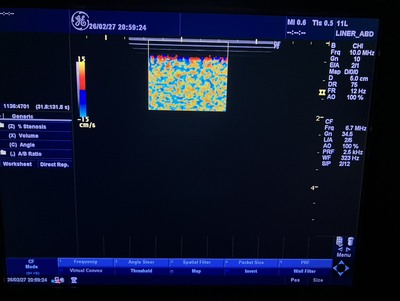 Color Doppler&nbsp;|&nbsp;GE&nbsp;|&nbsp;LOGIQ P5