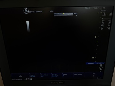 Color Doppler&nbsp;|&nbsp;GE&nbsp;|&nbsp;LOGIQ e V2