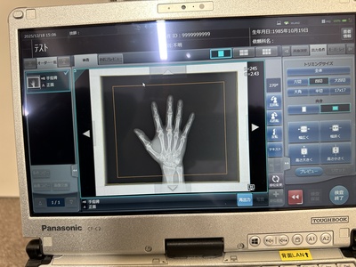 DR System&nbsp;|&nbsp;KONICA MINOLTA&nbsp;|&nbsp;AERO DR