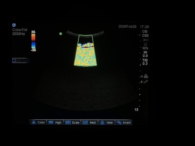 Color Doppler&nbsp;|&nbsp;SonoSite&nbsp;|&nbsp;M-Turbo