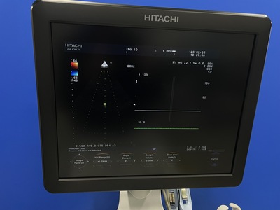 Color Doppler&nbsp;|&nbsp;HITACHI&nbsp;|&nbsp;F37