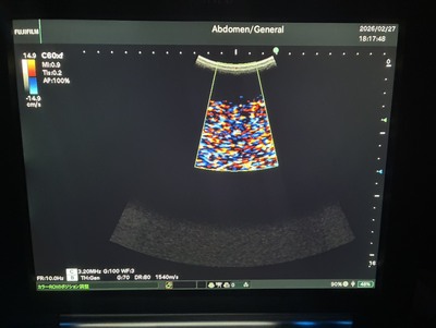 Portable Ultrasound&nbsp;|&nbsp;FUJIFILM&nbsp;|&nbsp;FC1-X