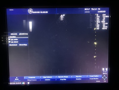 Color Doppler&nbsp;|&nbsp;GE&nbsp;|&nbsp;LOGIQ P5