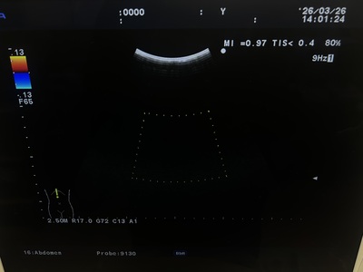Ultrasound System&nbsp;|&nbsp;HITACHI&nbsp;|&nbsp;Prosound α7