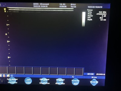 Color Doppler&nbsp;|&nbsp;GE&nbsp;|&nbsp;Vivid i