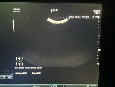 Ultrasound System&nbsp;|&nbsp;HITACHI&nbsp;|&nbsp;ARIETTA 60