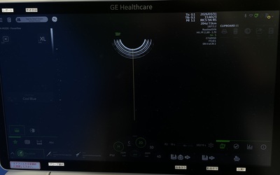 4D Ultrasound&nbsp;|&nbsp;GE&nbsp;|&nbsp;Voluson Swift BT23