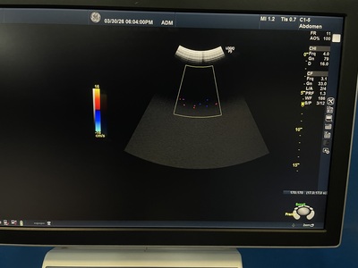 Ultrasound&nbsp;|&nbsp;GE&nbsp;|&nbsp;LOGIQ P9