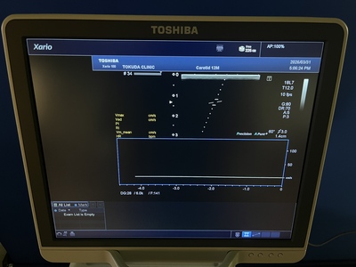 Color Doppler&nbsp;|&nbsp;CANON&nbsp;|&nbsp;TUS-X100 Xario 100