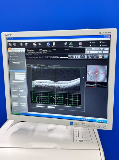 ENTRY Model of OCT&nbsp;|&nbsp;NIDEK&nbsp;|&nbsp;RS-3000 Lite
