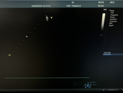 Ultrasound System&nbsp;|&nbsp;GE&nbsp;|&nbsp;Vivid S60N