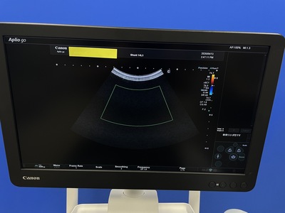 Ultrasound System&nbsp;|&nbsp;CANON&nbsp;|&nbsp;Aplio Go
