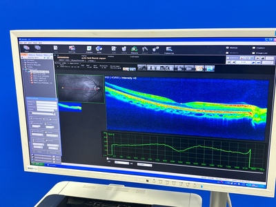 OCT with Fundus function&nbsp;|&nbsp;NIDEK&nbsp;|&nbsp;RS-3000