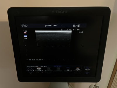 Color Doppler&nbsp;|&nbsp;HITACHI&nbsp;|&nbsp;F37