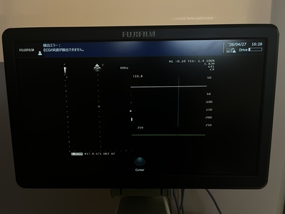 Ultrasound System&nbsp;|&nbsp;FUJIFILM&nbsp;|&nbsp;ARIETTA 50