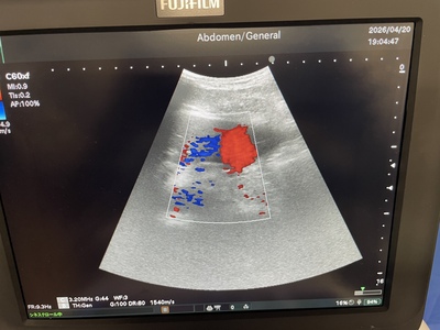 Portable Ultrasound&nbsp;|&nbsp;FUJIFILM&nbsp;|&nbsp;FC1-X