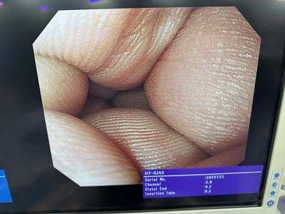 Video Gastroscope&nbsp;|&nbsp;OLYMPUS&nbsp;|&nbsp;GIF-Q260