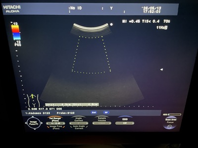 Color Doppler&nbsp;|&nbsp;HITACHI&nbsp;|&nbsp;F37