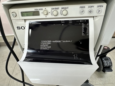 Ultrasound&nbsp;|&nbsp;GE&nbsp;|&nbsp;Versana Active