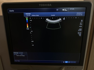 Color Doppler&nbsp;|&nbsp;CANON&nbsp;|&nbsp;Xario 200