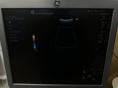 Color Doppler&nbsp;|&nbsp;GE&nbsp;|&nbsp;Logiq S7 Expert