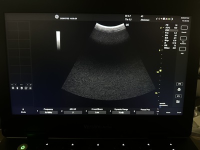 Portable Color doppler&nbsp;|&nbsp;GE&nbsp;|&nbsp;Versana Active