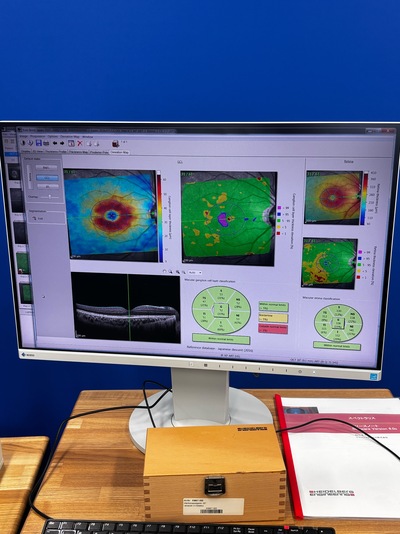 HRA2+ OCT+ WWE(55°), Retina and Glaucoma Module&nbsp;|&nbsp;Heidelberg Engineering GmbH&nbsp;|&nbsp;SPECTRALIS OCT2