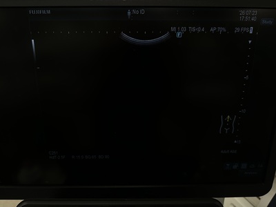 Ultrasound&nbsp;|&nbsp;FUJIFILM&nbsp;|&nbsp;ARIETTA 850SE