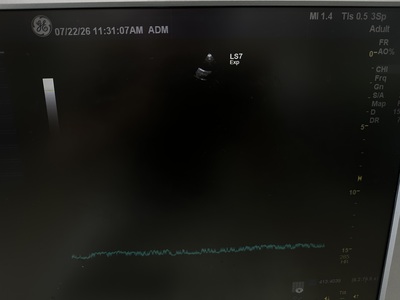 Color Doppler&nbsp;|&nbsp;GE&nbsp;|&nbsp;Logiq S7 Expert