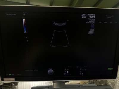 4D Ultrasound&nbsp;|&nbsp;GE&nbsp;|&nbsp;Voluson E8 BT18