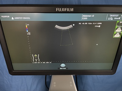 Ultrasound System&nbsp;|&nbsp;FUJIFILM&nbsp;|&nbsp;ARIETTA 50