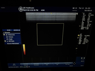 Color Doppler&nbsp;|&nbsp;GE&nbsp;|&nbsp;LOGIQ e Expert