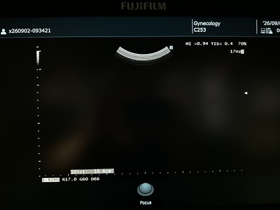 Ultrasound System&nbsp;|&nbsp;FUJIFILM&nbsp;|&nbsp;ARIETTA 50