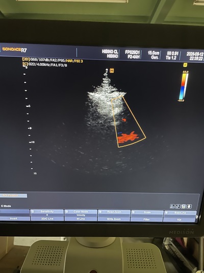 3D Ultrasound&nbsp;|&nbsp;SAMSUNG MEDISON&nbsp;|&nbsp;SonoAce R7