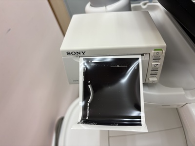 Ultrasound&nbsp;|&nbsp;Philips&nbsp;|&nbsp;Affiniti 30