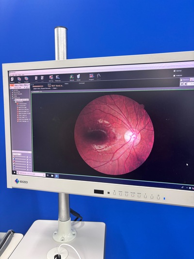 12-megapixel fundus photography × ultra-high-definition OCT&nbsp;|&nbsp;NIDEK&nbsp;|&nbsp;RS-330 Retina Scan Duo