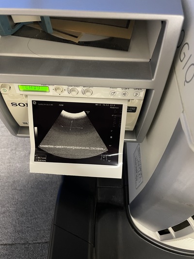 Color Doppler&nbsp;|&nbsp;GE&nbsp;|&nbsp;Logiq S8 XDclear