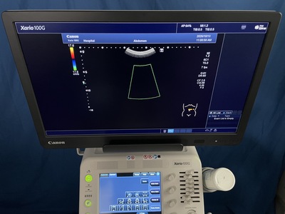 Ultrasound System&nbsp;|&nbsp;TOSHIBA&nbsp;|&nbsp;Xario 100G