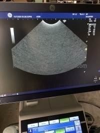 超音波診断装置&nbsp;|&nbsp;GEヘルスケア・ジャパン株式会社&nbsp;|&nbsp;LOGIQ P7の写真