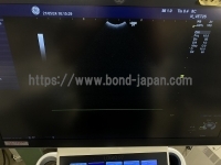 超音波診断装置&nbsp;|&nbsp;GEヘルスケア・ジャパン株式会社&nbsp;|&nbsp;LOGIQ P7の写真