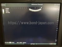 超音波診断装置&nbsp;|&nbsp;富士フイルムメディカル株式会社&nbsp;|&nbsp;FC1 P18011の写真