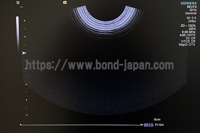 超音波診断装置&nbsp;|&nbsp;持田シーメンスメディカルシステム株式会社&nbsp;|&nbsp;Acuson S1000の写真