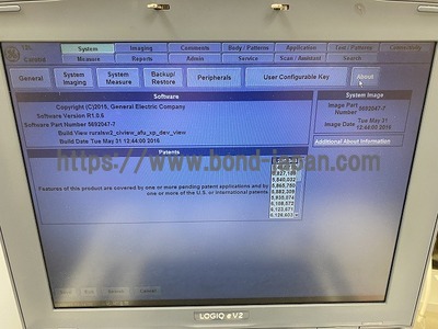 超音波診断装置/カラードプラ&nbsp;|&nbsp;GEヘルスケア・ジャパン株式会社&nbsp;|&nbsp;LOGIQ e V2の写真