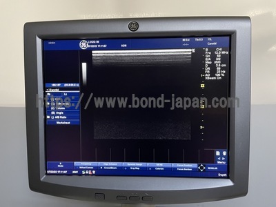 超音波診断装置/カラードプラ&nbsp;|&nbsp;GEヘルスケア・ジャパン株式会社&nbsp;|&nbsp;LOGIQ iMの写真
