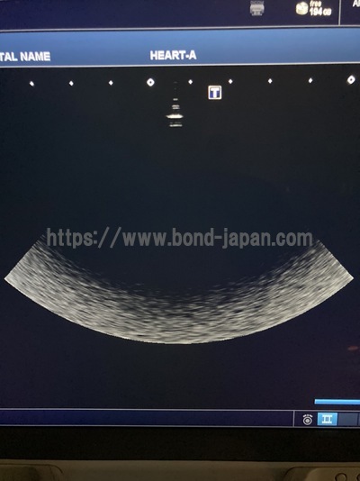 超音波診断装置/カラードプラ&nbsp;|&nbsp;キャノンメディカル株式会社&nbsp;|&nbsp;Aplio 300の写真
