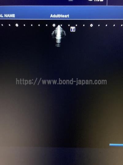 超音波診断装置/カラードプラ&nbsp;|&nbsp;キャノンメディカル株式会社&nbsp;|&nbsp;TUS-X100 Xario 100の写真