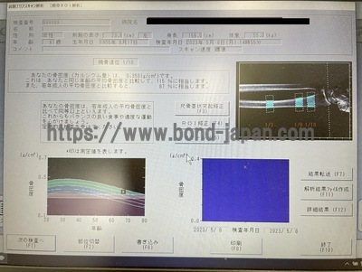 X線骨密度測定装置&nbsp;|&nbsp;富士フィルムヘルスケア株式会社&nbsp;|&nbsp;ALPHYS Aの写真