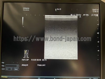 Ultrasound System&nbsp;|&nbsp;HITACHI&nbsp;|&nbsp;ARIETTA 60