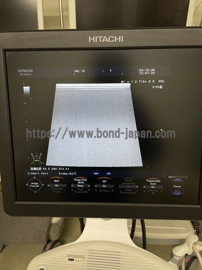 Color Doppler&nbsp;|&nbsp;HITACHI&nbsp;|&nbsp;F37