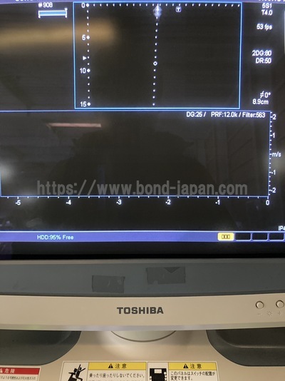 Color Doppler&nbsp;|&nbsp;CANON&nbsp;|&nbsp;SSA-660A Xario